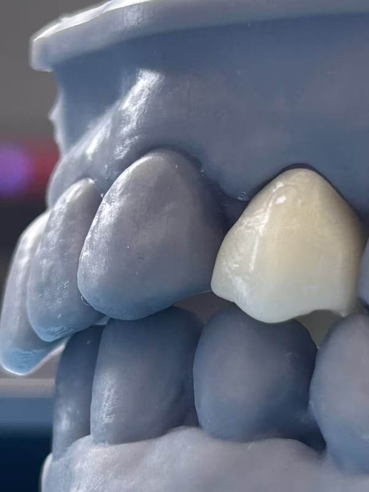 Laboratorio Dental
